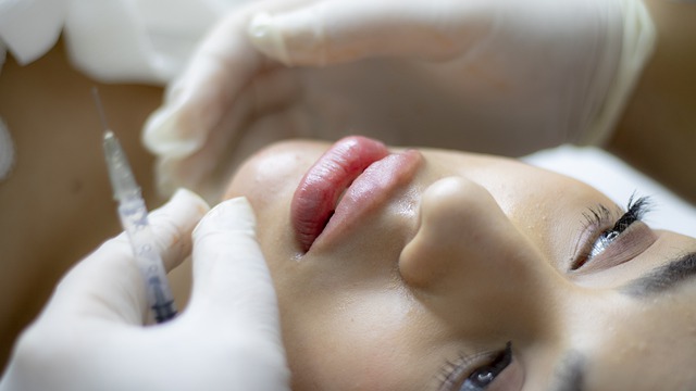 lip-filler-g55f839066_640 lip-filler-g55f839066_640