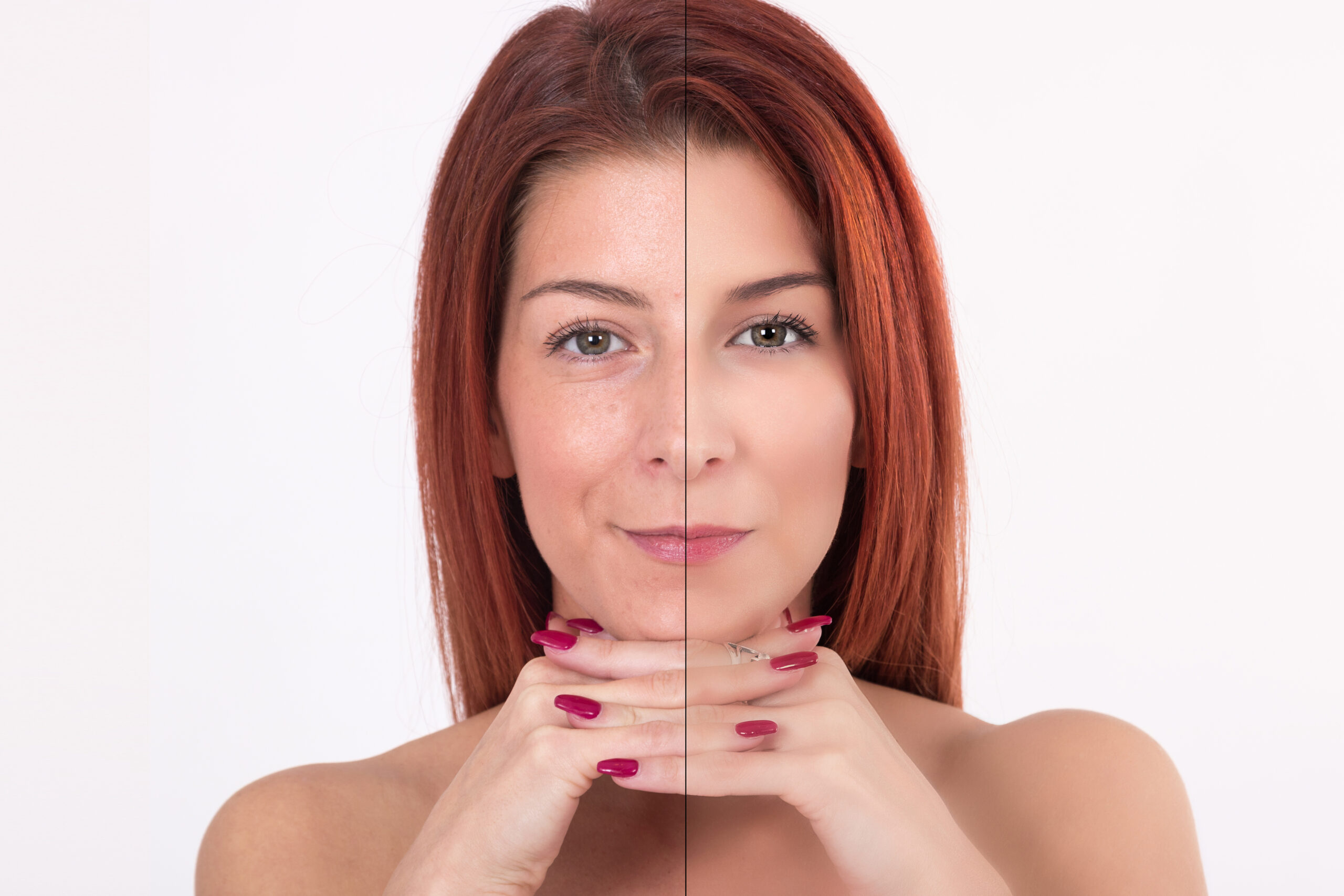 Before and after beauty treatment Littlehampton anti aging comparison